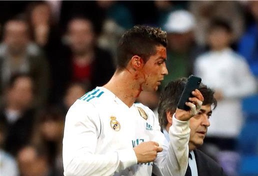 ريال مدريد يسحق ديبورتيفو لاكورونيا في ليلة العودة الكبيرة واصابة رونالدو