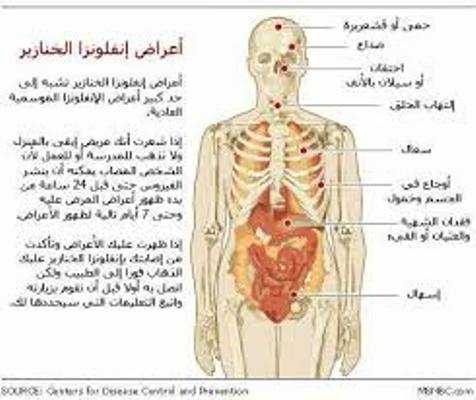 فيروس أشبه بإنفلونزا الخنازير يحصد أرواح العشرات من اليمنيين في العاصمة صنعاء