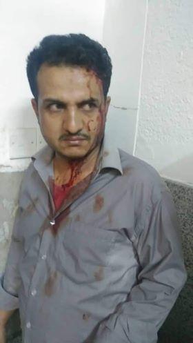 Houthi pressures to acquit a houthi gunman from the attack on a doctor