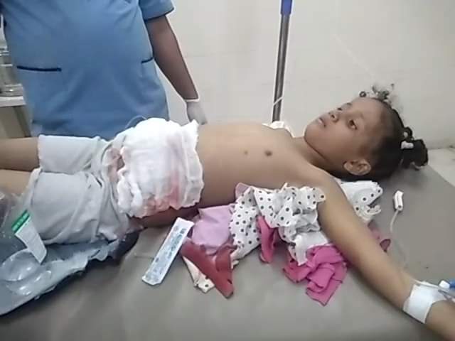 إصابة طفلة في تعز برصاص قناص حوثي