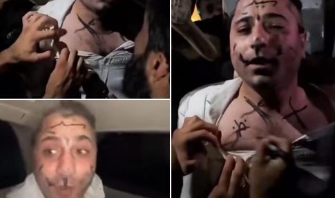 عمر خيري يظهر مبتسمًا ومغنيًا رغم حلق شعره والكتابة على وجهه