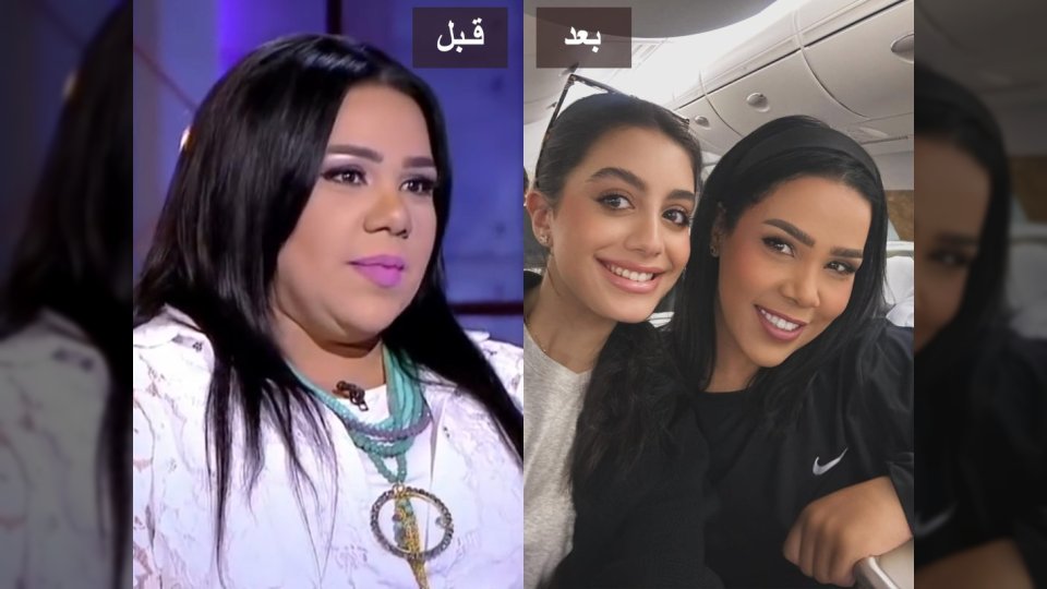 عملية تكميم أم رجيم.. شيماء سيف تتصدر التريند بعد فقدان وزنها