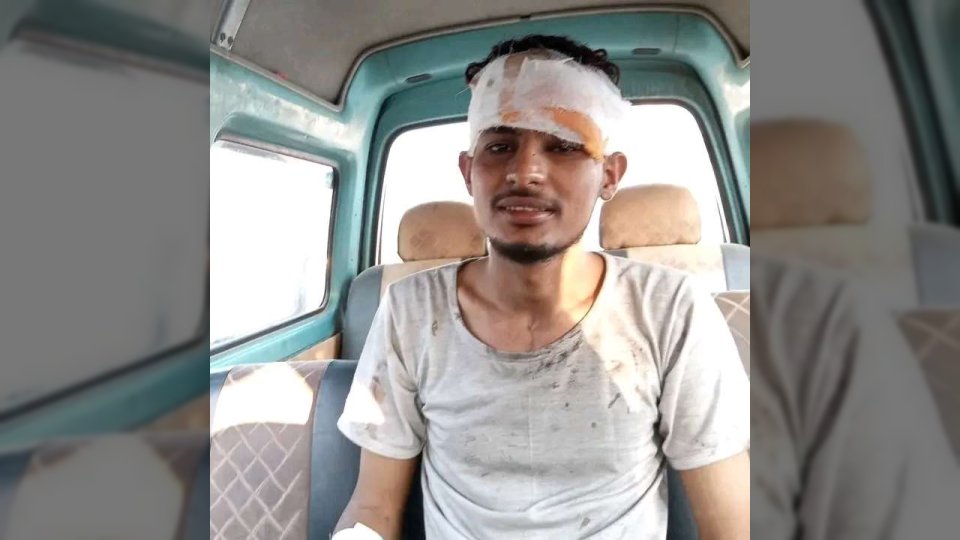 ناجٍ من حريق باص أبين يكشف تفاصيل صادمة عن اللحظات الأولى للحادث